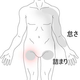 胸郭出口症候群