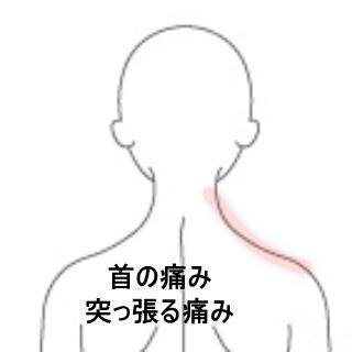 頸の痛み