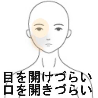 目の開きが悪い