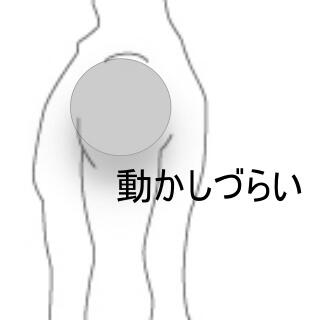 側方挙上の肩の痛み