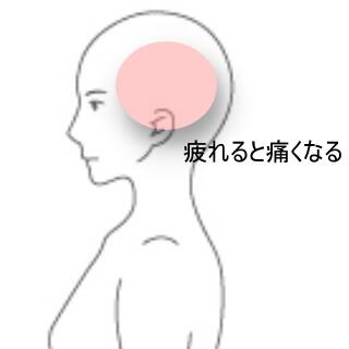 頭痛