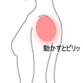 肩の痛み