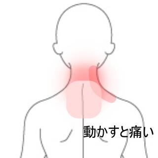 首の痛み