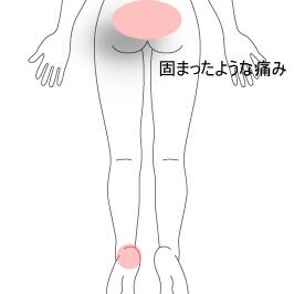 踵の痛み腰痛