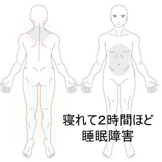 睡眠障害
