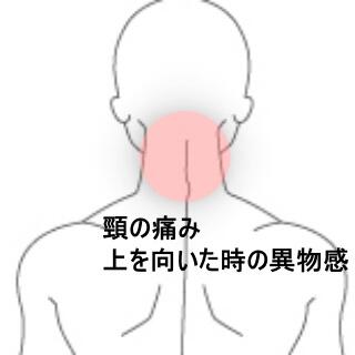 頸の痛み