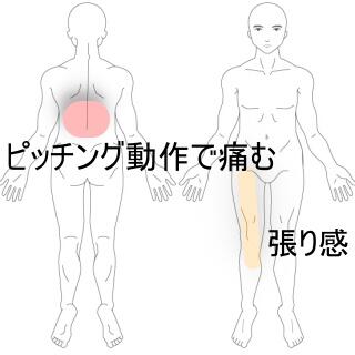 大腿部張り感