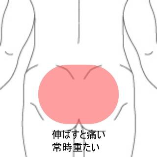 腰痛