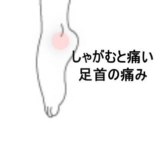 足首の痛み