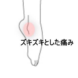 足関節の痛み