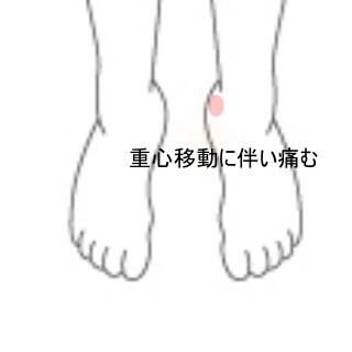 踵の痛み