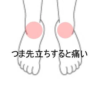 足首痛