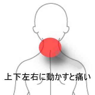 寝違え