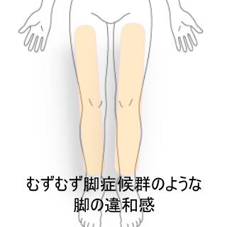 ムズムズ脚症候群