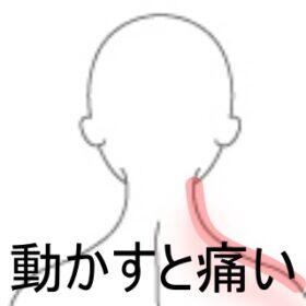 頸部痛
