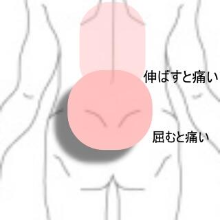 腰背部痛