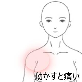 肩の痛み