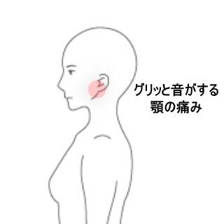 顎関節症