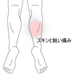 ふくらはぎの痛み2