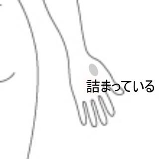 手指の痛み