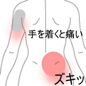 腰の痛み手の痛み