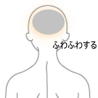 めまい