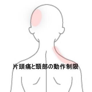 頸部の痛み　