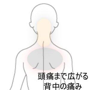 ソファー頭痛