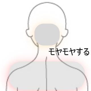 後頭部痛
