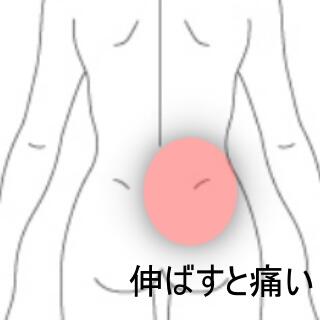 腰臀部痛