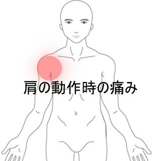 肩の痛み