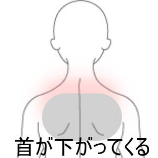 首下がり症候群