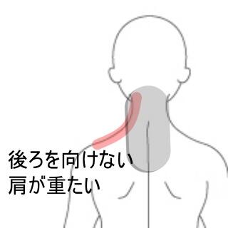 頸部痛