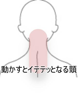 頸の痛み
