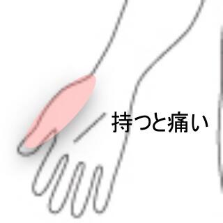 親指の痛み