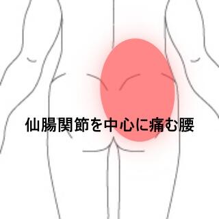 腰痛