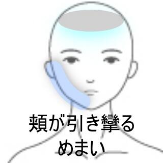 顔面神経麻痺