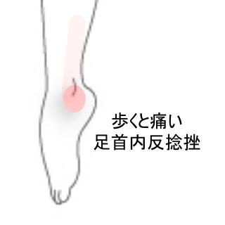足の痛み