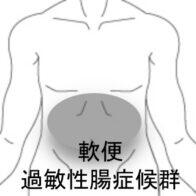 IBS