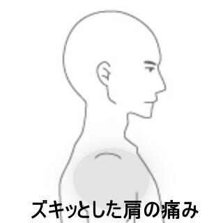 肩の痛み