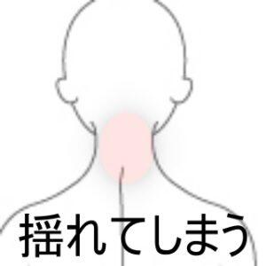 くび
