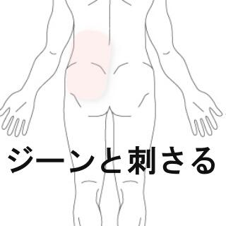 ぎっくり腰