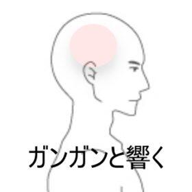 側頭部痛