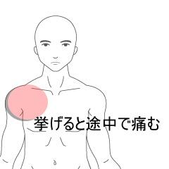 肩の痛み