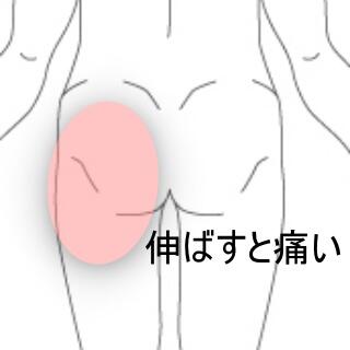 臀部痛