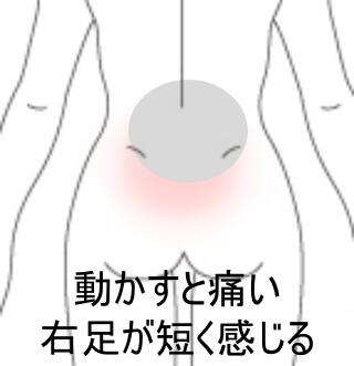 逃避性腰痛