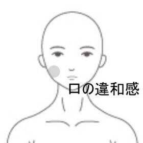 顎関節症