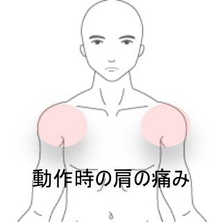 肩の痛み