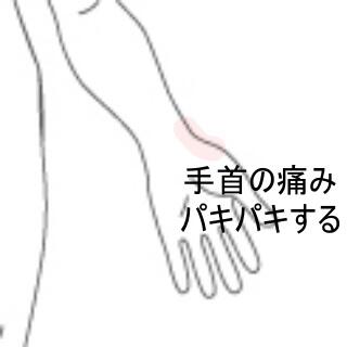 手首の痛み
