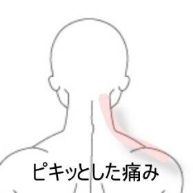 首の寝違い